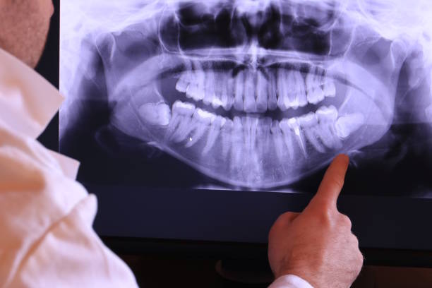 Best Emergency Denture Repair in Gaffney, SC